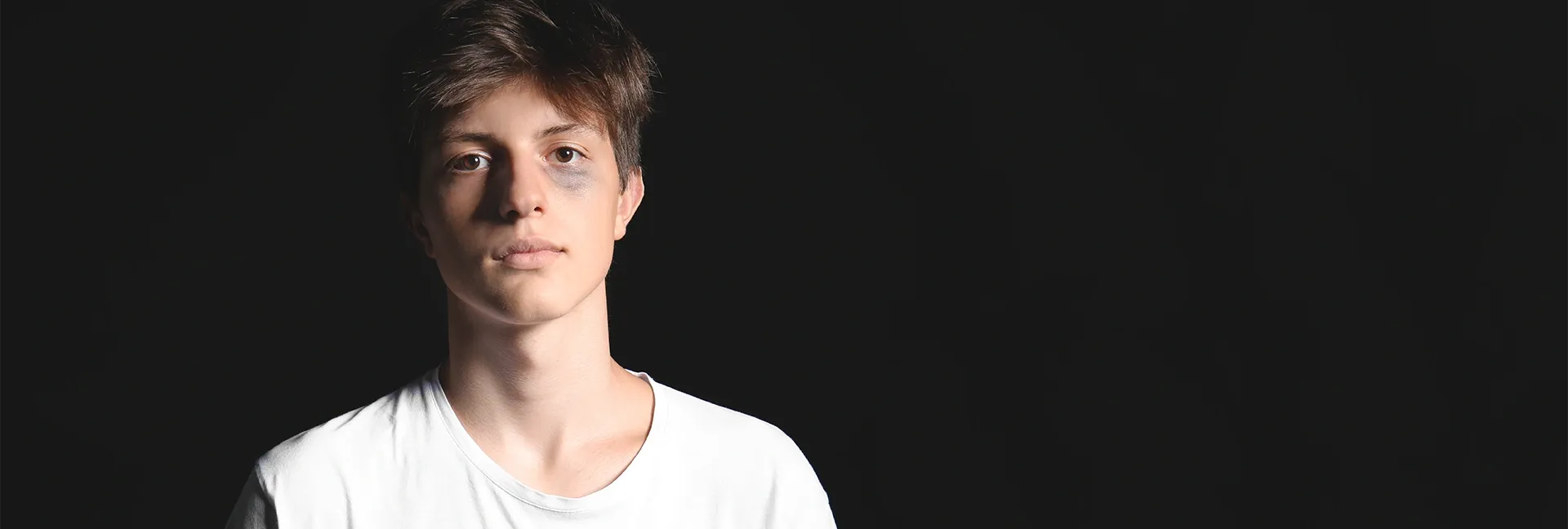 Sad teenage boy with a bruised eye
